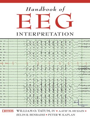 cover image of Handbook of EEG Interpretation